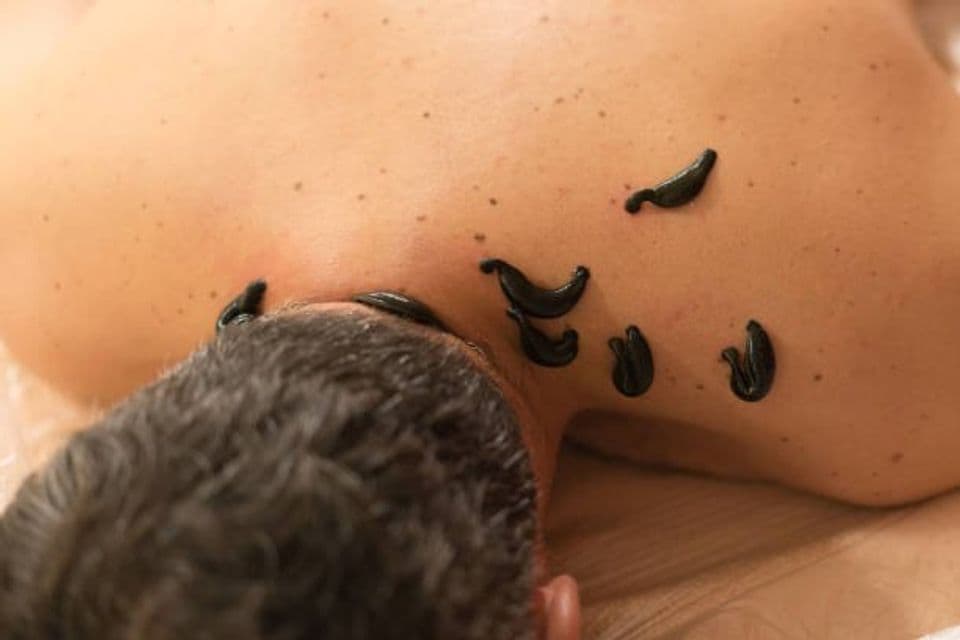 Proses Awal dan Proses Lanjutan Budidaya Lintah, Alat Utama Terapi Kesehatan